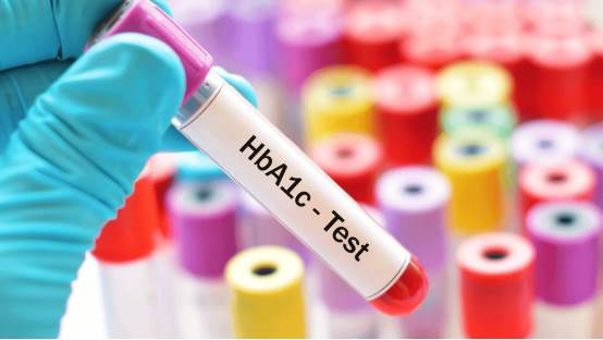 ¿Qué es la prueba de hemoglobina glucosilada (HbA1c)?